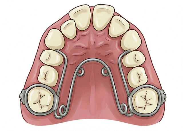 クワドヘリックス